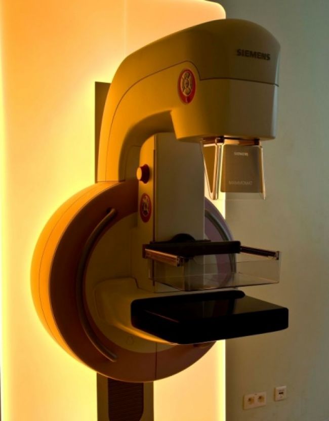 Košická nemocnica získala prvý digitálny mamograf v kraji