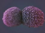 Biologické hodiny človeka môžu pomôcť liečiť rakovinu