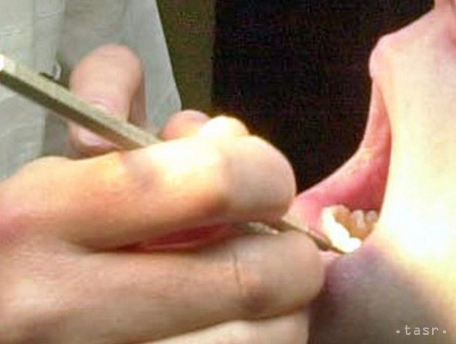 Prevencia je najlacnejším spôsobom liečby ústnej dutiny