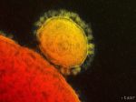 V USA zaznamenali prvý prípad výskytu nebezpečného vírusu MERS