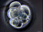 Vedci chcú vytvoriť embryá z DNA troch ľudí