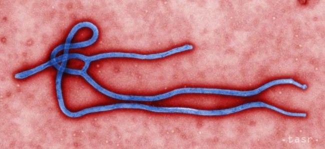 V Kanade hospitalizovali muža s pravdepodobnými príznakmi eboly