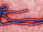 V Kanade hospitalizovali muža s pravdepodobnými príznakmi eboly