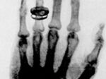 Röntgenové žiarenie objavili pred 119 rokmi
