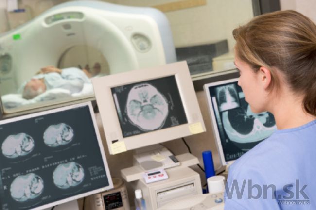 Šéfka Medical Group končí, doplatila na kauzu CT prístroja