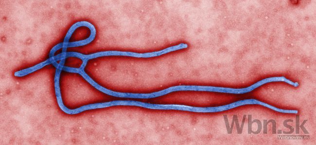 Epidémia eboly by mohla byť podľa OSN ukončená v roku 2015