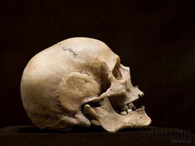 V objekte polikliniky v Prešove našli zakopané ľudské kosti