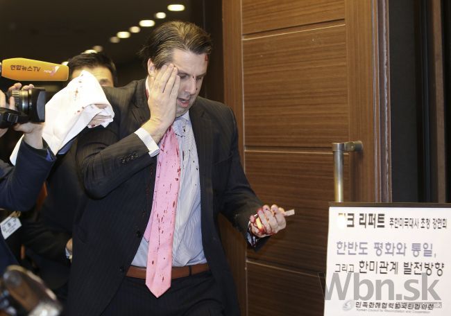Video: Šialenec v Južnej Kórei zaútočil na veľvyslanca USA