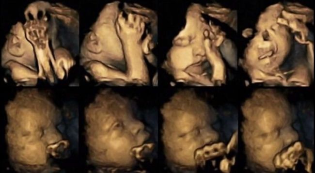 Video: Fajčenie v tehotenstve. Čo sa robí v brušku s bábätkom