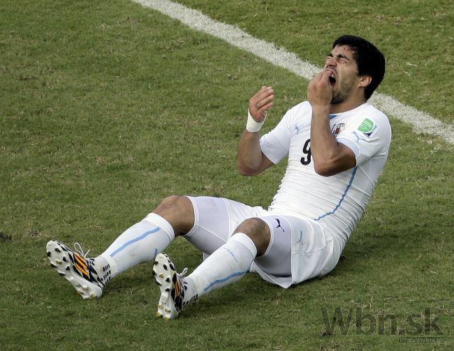 Suárez nehryzie jediný, anglický futbalista je nový kanibal