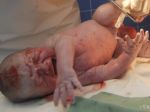Trnavská nemocnica zaplatí odškodné za postihnuté dieťa 480.000 eur