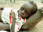 Chronickým hladom trpí 805 miliónov ľudí