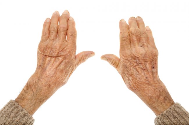 Prvá pomoc pre ruky postihnuté artritídou