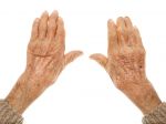 Prvá pomoc pre ruky postihnuté artritídou