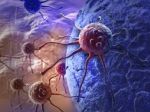 Svetový deň boja s rakovinou pankreasu bude fialový