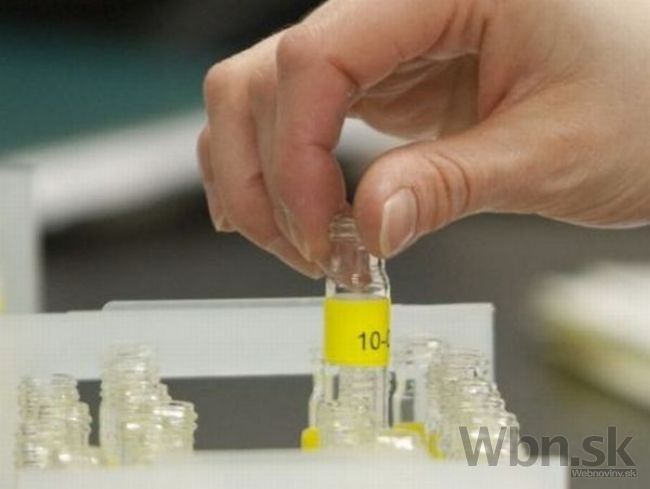 Rusi utvorili pracovnú skupinu, ktorá má vykynožiť doping