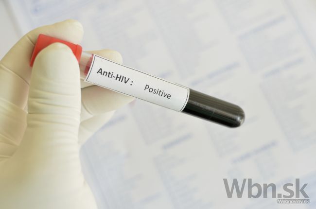 Nákaza vírusom HIV ohrozuje aj heterosexuálov