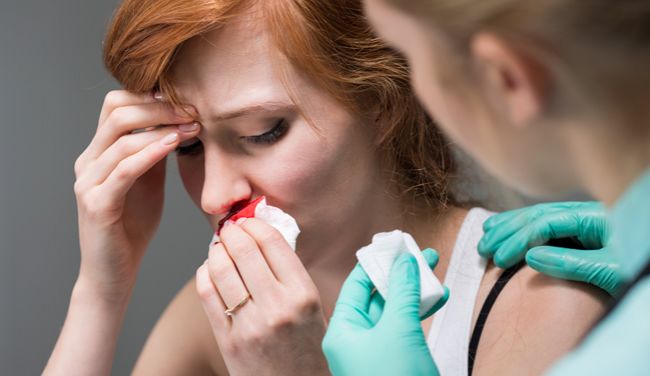 Krvácanie z nosa: Čo signalizuje a ako ho rýchlo zastaviť?