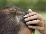 Šedivenie vlasov: Ako ho zastaviť pomocou mladej pšenice