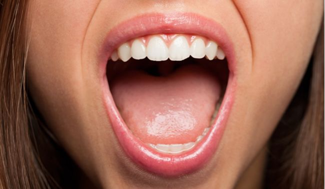 Syndróm pálenia v ústach – čo pomáha? 