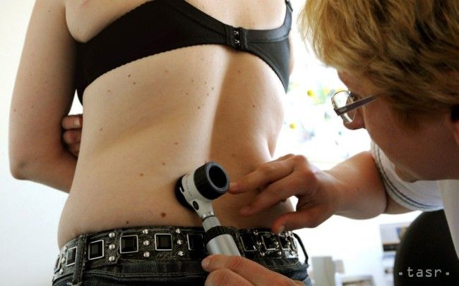Znamienka netreba podceňovať, život môže zachrániť prevencia