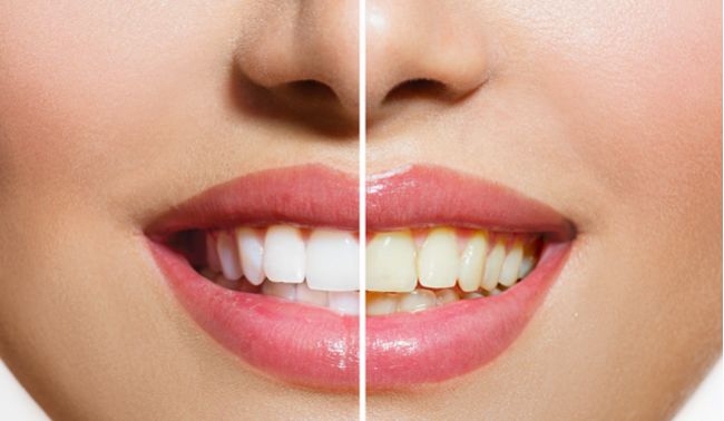 12 potravín, ktoré udržujú zuby biele
