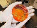 Epidémia salmonelózy v Banskej Bystrici sa rozrástla, chorých je už 27