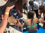 FOTO: Ženu pohrýzol žralok, na jej ruke bol pripevnený až do nemocnice