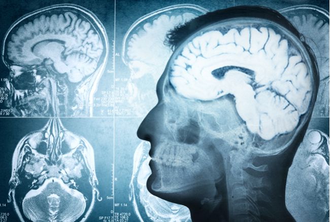 Čo robí negatívne myslenie s našim mozgom?