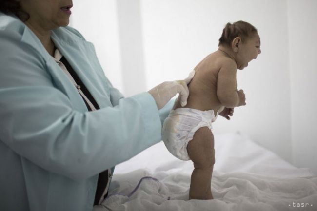 V Barcelone sa narodilo dieťa s príznakmi mikrocefálie