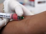 PRIESKUM: Česi sa nákazy vírusom HIV neobávajú