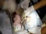 Pri požiari v bagdadskej pôrodnici zahynulo najmenej 11 detí