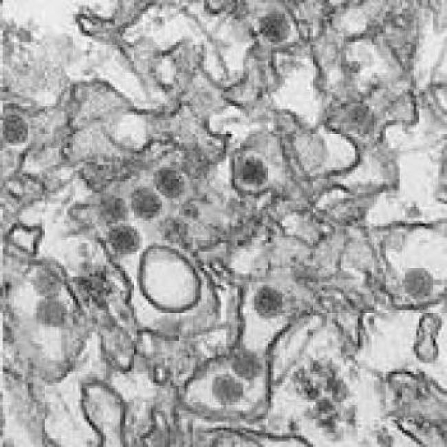 Brazílski vedci: Komáre rodu culex neprenášajú vírus zika