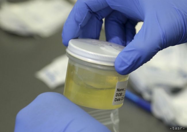 Zika sa blíži, v Česku malo od februára pozitívny test až 20 ľudí