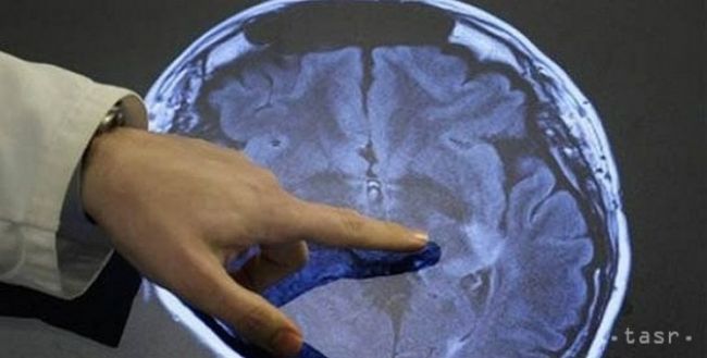 Alzheimerova choroba postihuje 50.000 až 60.000 ľudí na Slovensku