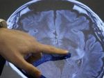 Alzheimerova choroba postihuje 50.000 až 60.000 ľudí na Slovensku