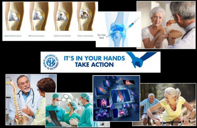 Svetový deň osteoartrózy a reumatoidnej artritídy