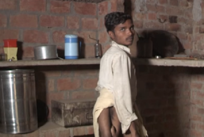 Video: Muž sa narodil so štyrmi nohami. Nikto ho nechcel operovať