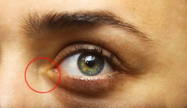 8 varovných signálov chorôb, ktoré môžete vidieť na svojej tvári