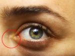 8 varovných signálov chorôb, ktoré môžete vidieť na svojej tvári