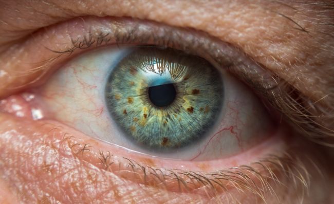 6 závažných diagnóz, ktoré sa prejavia cez vaše oči