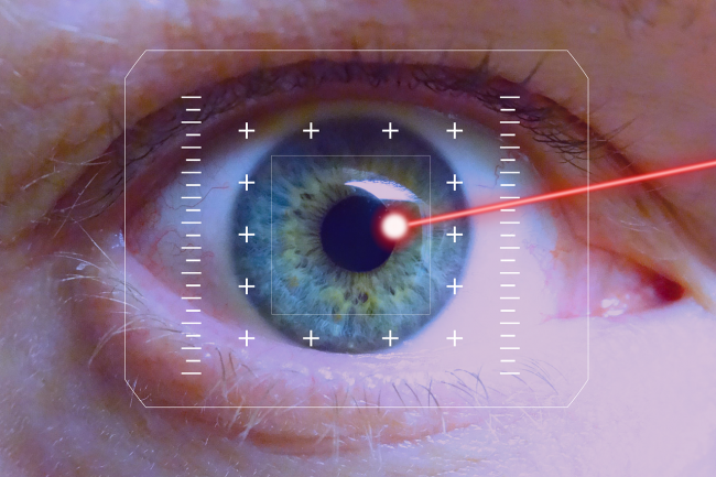 Laserová operácia očí nie je vhodná pre každého