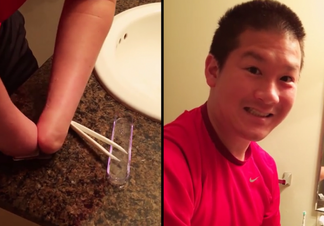 Video: Muž bez rúk si dokáže nasadiť kontaktné šošovky. Sledujte, ako