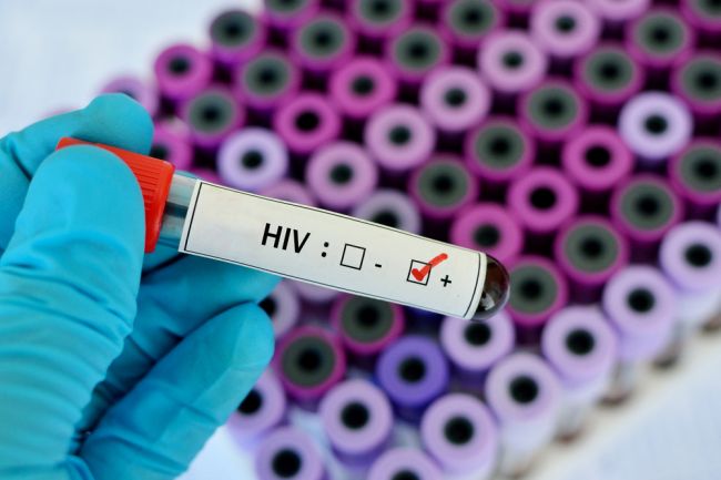 Muža, ktorý vraj zatajoval, že je HIV pozitívny, odsúdili na 5 rokov väzenia