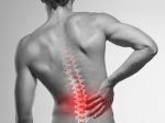 Dlhodobá bolesť krížov značí zápal chrbtice, ak sa to zanedbá, môže zvápenatieť