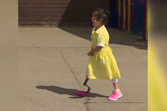 Video: Dievčatko ukázalo spolužiakom protézu. Ich reakcia vás dojme