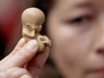 Počet umelých potratov za 10 rokov klesol, pribúdajú však spontánne