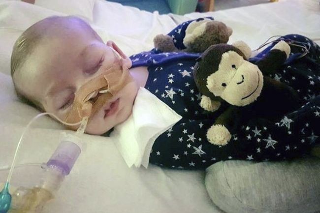 11-mesačný Charlie Gard prehral svoj boj o život