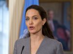 Angelina Jolie sa zverila so svojím ochorením: Čo je Bellovo ochrnutie?