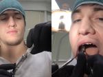 Video: Zubár si sám vytrhol zub a zašil ranu